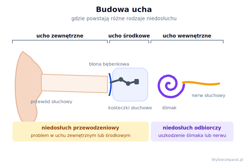 Przekrój ucha z podziałem na ucho zewnętrzne, środkowe i wewnętrzne oraz zaznaczeniem, gdzie powstaje niedosłuch przewodzeniowy i odbiorczy